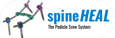 spineHEAL — Pedicle Screw System Brand by GPC Medical USA