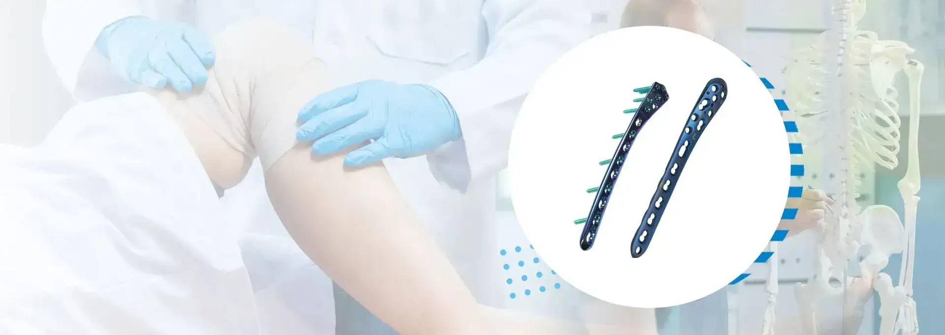 fixLOCK Locking Plating System — GPC Medical USA